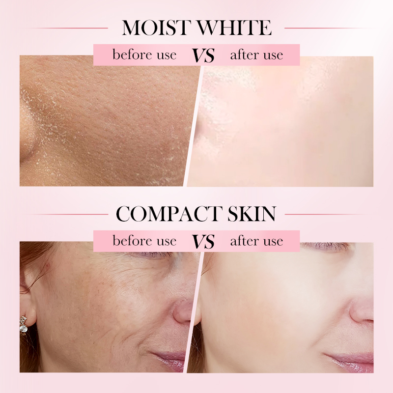 4 in 1 Hyaluronic Acid + Nicotinamide + Vitamin C+E Face Serum - Image 7